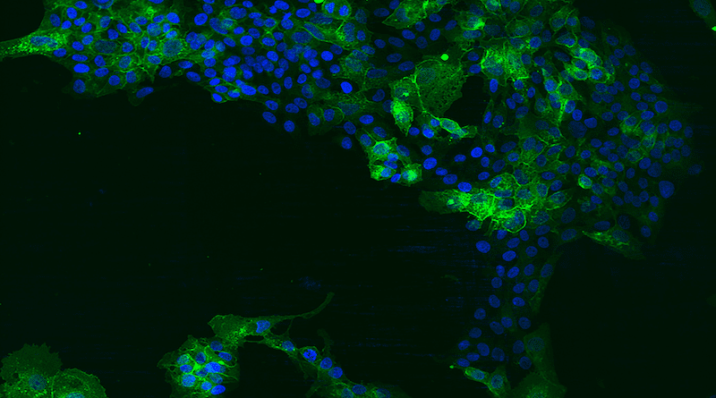 Hepatoma cells overexpressing EGFR are shown here in green. The cell nucleus is stained in blue.© Abteilung für Molekulare und Medizinische Virologie The image may only be used in the context of the press release "How hepatitis E viruses enter cells" published by RUB on 9.2.2023.