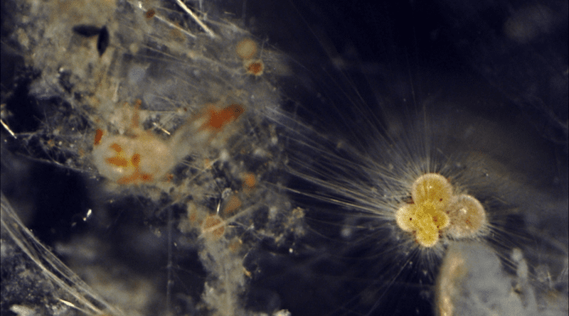 It is not possible to see plankton preserved in sediments in a recognisable form. The image shows a light microscope image of marine organic matter collected with a plankton net from the Southwest Indian Ocean aboard the GLOW Cruise. CREDIT: Dr Tracy Aze, University of Leeds