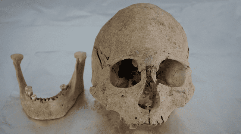 Cranium and mandible of an individual from Zongri (5213-3716 cal BP), an archaeological site from the Gonghe Basin in Qinghai, in the northeastern region of the Tibetan Plateau CREDIT: FU Qiaomei