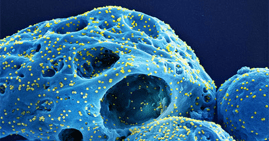 A colorized scanning electron micrograph of cells (blue) infected with the Omicron strain of SARS-CoV-2 virus (yellow), isolated from a patient sample. Variants of the original COVID-19 virus evolved to better dodge vaccine protections and immune response. CREDIT: National Institute of Allergy and Infectious Diseases (NIAID)