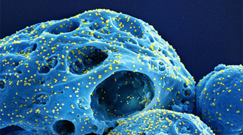 A colorized scanning electron micrograph of cells (blue) infected with the Omicron strain of SARS-CoV-2 virus (yellow), isolated from a patient sample. Variants of the original COVID-19 virus evolved to better dodge vaccine protections and immune response. CREDIT: National Institute of Allergy and Infectious Diseases (NIAID)