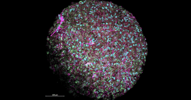 Magnified image of a brain organoid produced in Thomas Hartung’s lab, dyed to show neurons in magenta, cell nuclei in blue, and other supporting cells in red and green. CREDIT: Jesse Plotkin/Johns Hopkins University