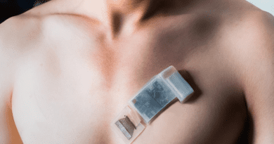 A wearable ultrasonic-system-on-patch mounted on the chest for measuring cardiac activity. CREDIT: Muyang Lin