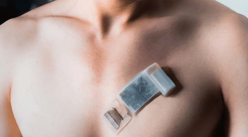 A wearable ultrasonic-system-on-patch mounted on the chest for measuring cardiac activity. CREDIT: Muyang Lin