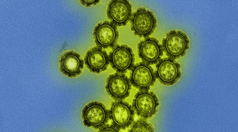 Colorized transmission electron micrograph showing H1N1 influenza virus particles. Surface proteins on the virus particles are shown in black. CREDIT: NIAID