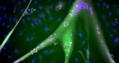 Differentiated immortalized bovine stem cells with fully expressed muscle proteins (blue = nuclei; magenta = myogenin; green = myosin). Scale approx 1 mm. CREDIT: Andrew Stout, Tufts University