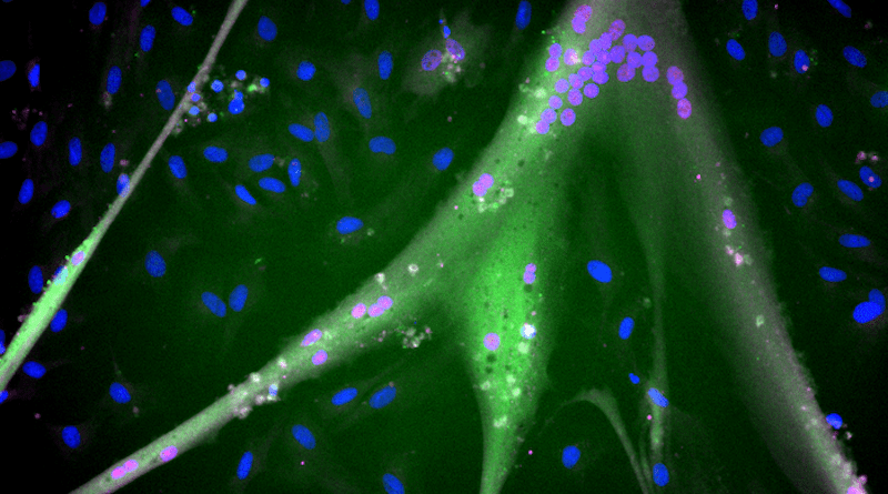 Differentiated immortalized bovine stem cells with fully expressed muscle proteins (blue = nuclei; magenta = myogenin; green = myosin). Scale approx 1 mm. CREDIT: Andrew Stout, Tufts University