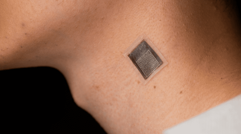 Ultrasound patch worn on the neck. CREDIT: UC San Diego Jacobs School of Engineering