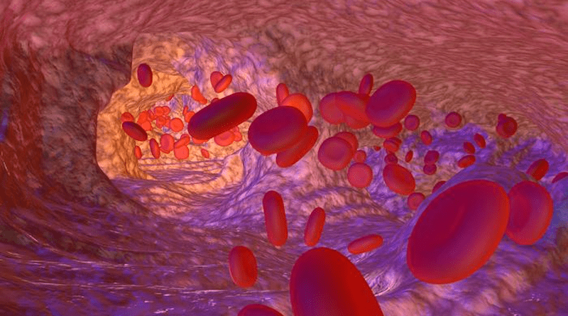 Blood cells. CREDIT: Wellcome collection.