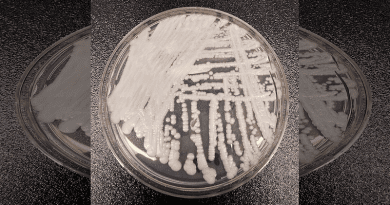 A strain of Candida auris cultured in a petri dish at a CDC laboratory. Photo Credit: Shawn Lockhart, CDC, Wikipedia Commons