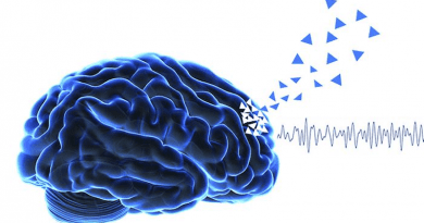 Early hallucinations in Parkinson's disease are associated with frontal cognitive decline (triangles), and preceded by specific frontal neural oscillation (theta frequency band). CREDIT: EPFL / Bernasconi.