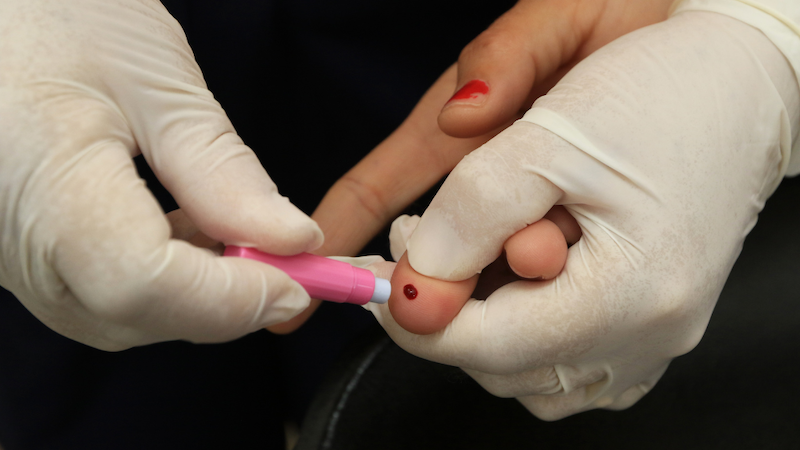 HIV is commonly tested using blood. Kiyohiko Izumi, team leader for sexually transmitted infections in the WHO says climate change can lead to increased vulnerability to HIV Copyright: Sandro Araújo/SES, (CC BY-NC-ND 2.0)