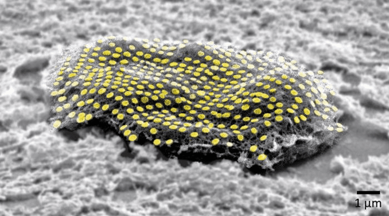 False-colored gold nanodot array on a fibroblast cell. CREDIT: Kam Sang Kwok and Soo Jin Choi, Gracias Lab/Johns Hopkins University.