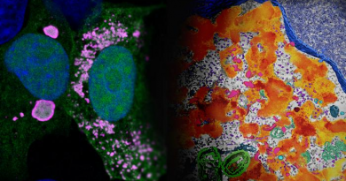 The image on the left was captured via confocal immunofluorescence microscopy and shows Ebola's viral factories in pink. The image on the right was captured using electron tomography and shows viral factories in orange. (Image courtesy Saphire Lab, La Jolla Institute for Immunology)