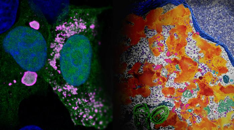 The image on the left was captured via confocal immunofluorescence microscopy and shows Ebola's viral factories in pink. The image on the right was captured using electron tomography and shows viral factories in orange. (Image courtesy Saphire Lab, La Jolla Institute for Immunology)