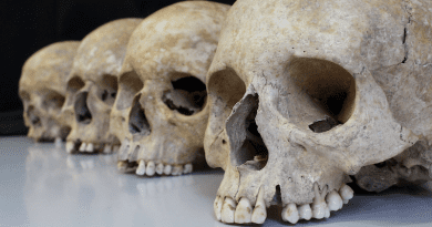 Skulls excavated from an archaeological site. Photo: University of Tübingen Osteological Collection
