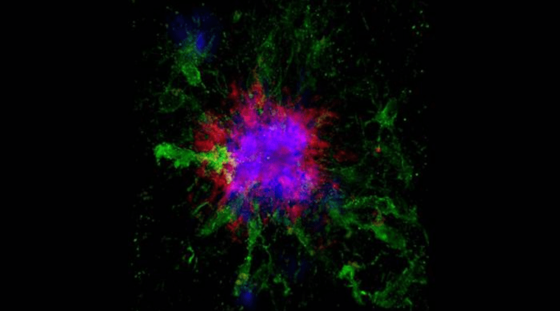 This confocal microscopy image shows amyloid plaques (blue and red) in the brain of a mouse. The accumulation of amyloid plaques is the most well-documented biochemical hallmark of Alzheimer’s disease. CREDIT: UC San Diego Health Sciences