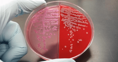 Microbiology lab media plates show E. coli bacteria growing on E. coli selective agar (pink) and blood agar (red). CREDIT: Sokurenko Lab/UW Medicine