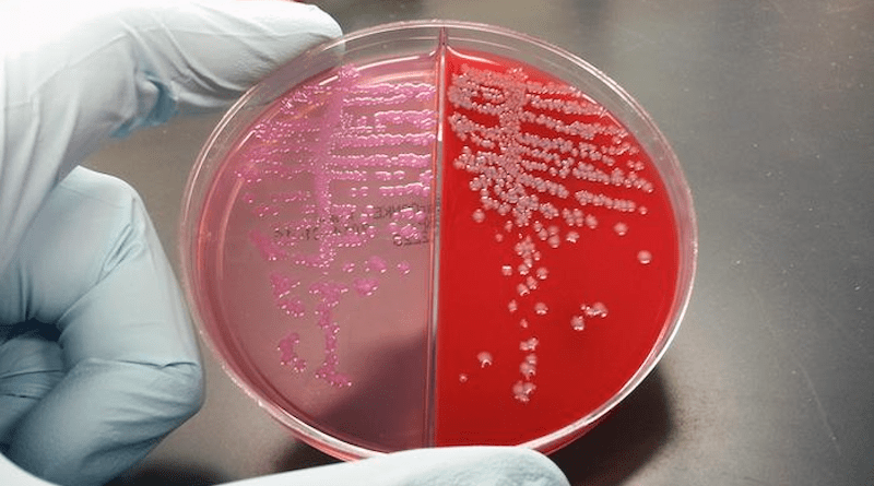 Microbiology lab media plates show E. coli bacteria growing on E. coli selective agar (pink) and blood agar (red). CREDIT: Sokurenko Lab/UW Medicine