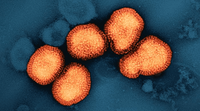 A colorized transmission electron micrograph of influenza A virus particles, colorized orange, isolated from a patient sample and then propagated in cell culture. CREDIT: NIAID