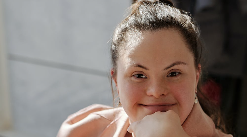 Down syndrome woman female
