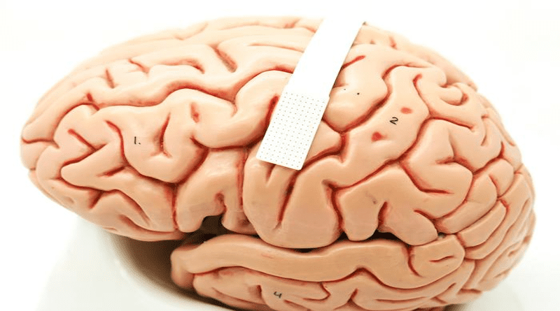 A device no bigger than a postage stamp (dotted portion within white band) packs 128 microscopic sensors that can translate brain cell activity into what someone intends to say. CREDIT: Dan Vahaba/Duke University