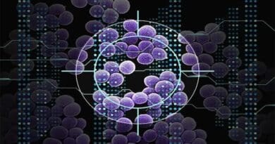 Using a type of artificial intelligence known as deep learning, MIT researchers have discovered a class of compounds that can kill a drug-resistant bacterium that causes more than 10,000 deaths in the United States every year. CREDIT: Christine Daniloff, MIT; Janice Haney Carr, CDC; iStock