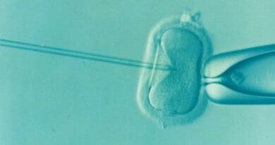in vitro fertilization (IVF)