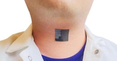 Photo of person’s neck with the device — a black adhesive square — attached outside the throat. CREDIT: Jun Chen Lab/UCLA