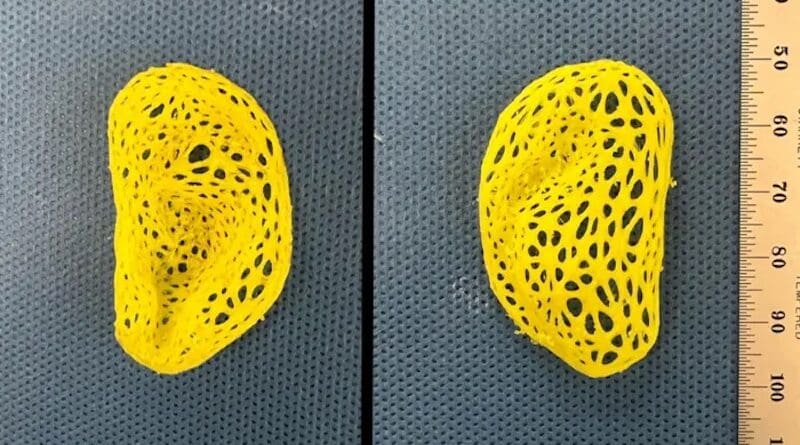 Pictured is the intricate, left-ear plastic scaffold that was created on a 3D printer based on data from a person’s ear, anterior view (left) and posterior view (right). CREDIT: Spector Lab