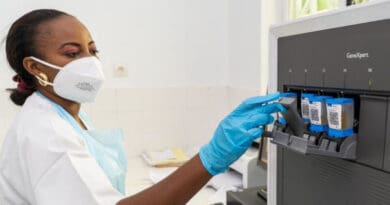 The GeneXpert machines in Brazzaville, Congo analyses around 70 samples every day to detect TB. Many people with the disease, which is particularly prevalent in the Asia Pacific region and Africa, do not even get properly diagnosed. Copyright: WHO/OLUSIMI Vijay.
