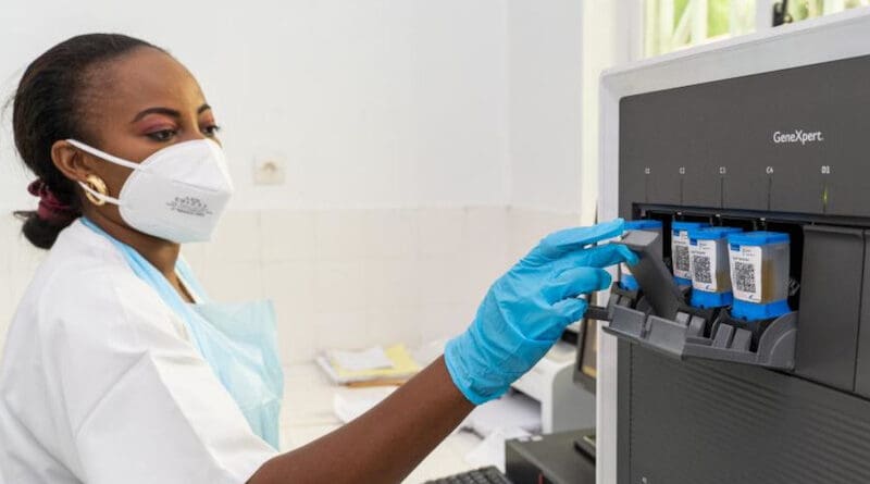 The GeneXpert machines in Brazzaville, Congo analyses around 70 samples every day to detect TB. Many people with the disease, which is particularly prevalent in the Asia Pacific region and Africa, do not even get properly diagnosed. Copyright: WHO/OLUSIMI Vijay.