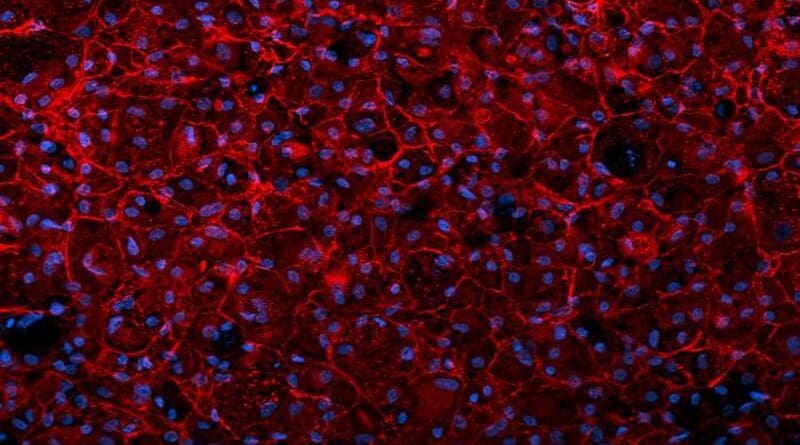 The image depicts human skin stem cells from which new, liver-like cells have been differentiated. The hepatic biomarker APF produced by the differentiated cells is coloured red. The DNA of cell nuclei is displayed in blue. CREDIT: University of Helsinki: Jalil, Keskinen et al.