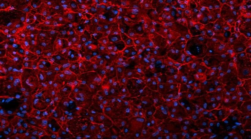 The image depicts human skin stem cells from which new, liver-like cells have been differentiated. The hepatic biomarker APF produced by the differentiated cells is coloured red. The DNA of cell nuclei is displayed in blue. CREDIT: University of Helsinki: Jalil, Keskinen et al.
