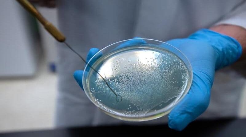 Washington State University researcher Arden Baylink holds a petri dish containing salmonella bacteria. Baylink and PhD student Siena Glenn have published research showing that some of the world's deadliest bacteria seek out and eat serum, the liquid part of human blood, which contains nutrients the bacteria can use as food. CREDIT: Ted S. Warren, Washington State University College of Veterinary Medicine