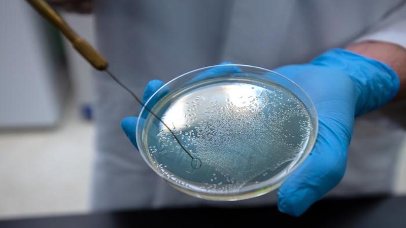 Washington State University researcher Arden Baylink holds a petri dish containing salmonella bacteria. Baylink and PhD student Siena Glenn have published research showing that some of the world's deadliest bacteria seek out and eat serum, the liquid part of human blood, which contains nutrients the bacteria can use as food. CREDIT: Ted S. Warren, Washington State University College of Veterinary Medicine