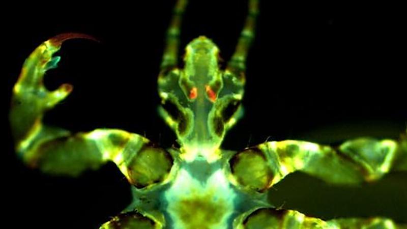Fluorescent image of a human body louse with Yersinia pestis infection (orange/red) in the Pawlowsky glands. CREDIT: David M. Bland
