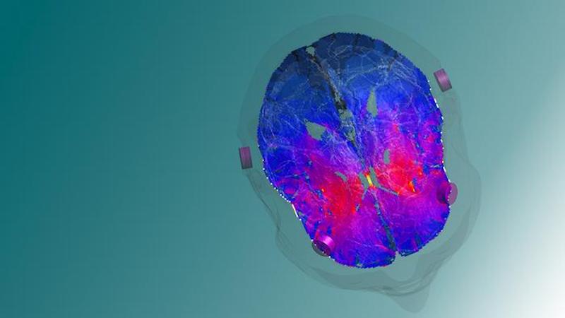 A model image of the targeted deep brain zone, the striatum, a key player in reward and reinforcement mechanisms. CREDIT: EPFL