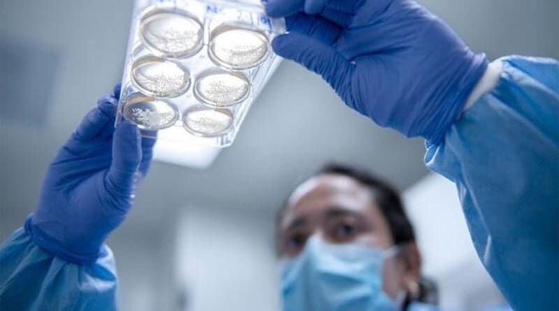 Brain cortical organoids (BCOs) created by Dr. Alysson Muotri shown in a 2019 file photo. Muotri and colleagues at the University of California San Diego used stem cells from toddlers with autism and created BCOs from them. The stem cells of toddlers with autism developed into larger BCOs, they discovered. Toddlers with autism also had larger brain volumes, according to MRI. CREDIT: UC San Diego Health Sciences