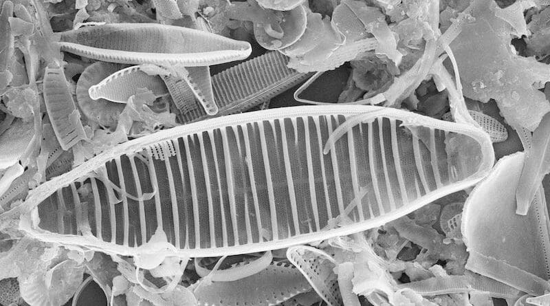 Diatoms viewed under the scanning electron microscope. Copyright: UDE/AG Phykologie/CCAC