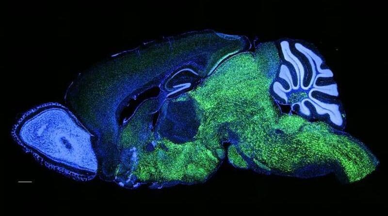 Expression pattern of NOVA1 in the brain of a mouse. NOVA1 in green, nuclei (DAPI) in blue. CREDIT: Laboratory of Molecular Neuro-oncology at The Rockefeller University