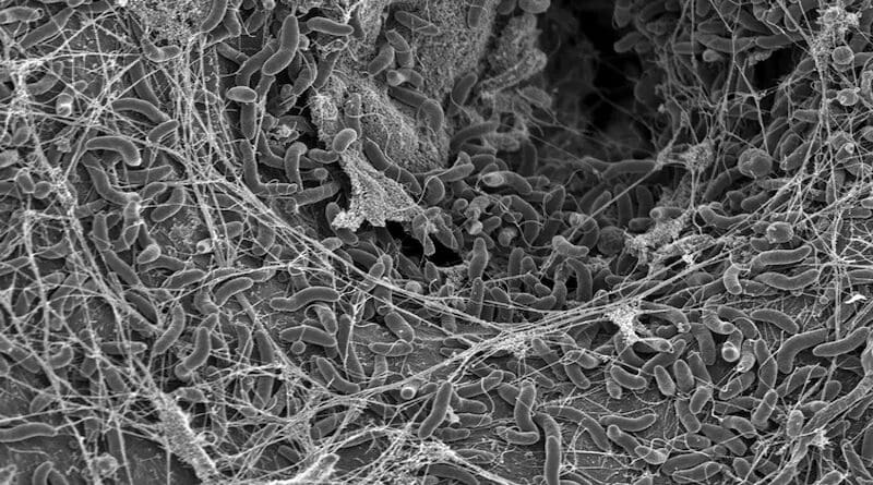 Vibrio cholerae bacteria, photo taken with a Scanning Electron Microscope. CREDIT: Graham Knott & Melanie Blokesch (EPFL)