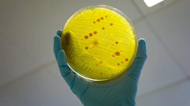 A plate of various bacteria being tested for antimicrobial resistance. In Malawi, nearly half of urinary tract infections are resistant to common antibiotics, according to a recent study. Copyright: Will Crowne / DFID