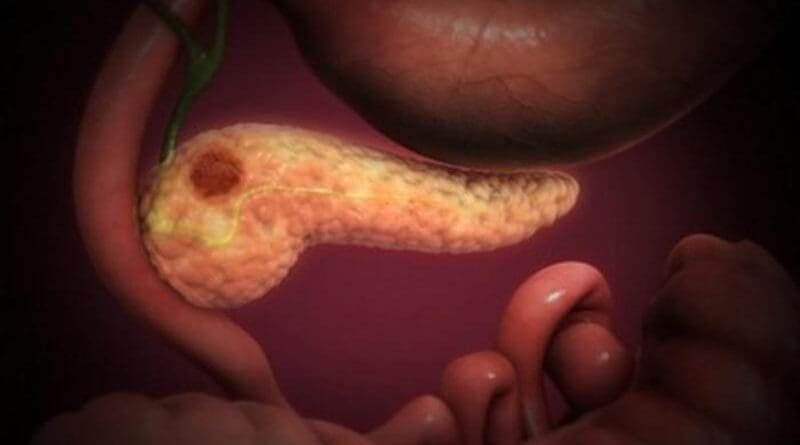 Benzaldehyde prevents Ser28-phosphorylated histone H3 from interacting with 14-3-3ζ, thereby preventing expression of genes related to treatment resistance, epithelial to mesenchymal plasticity, and cancer cell survival. CREDIT "Pancreatic Cancer" by Scientific Animations Inc. Image Source Link: https://openverse.org/image/d465039a-3408-42d2-beff-35b4959f0b8a?