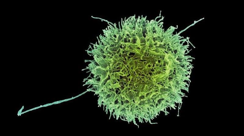 A new study identifies genetic modifications that make “natural killer” more effective at destroying cancer cells. CREDIT: NIAID