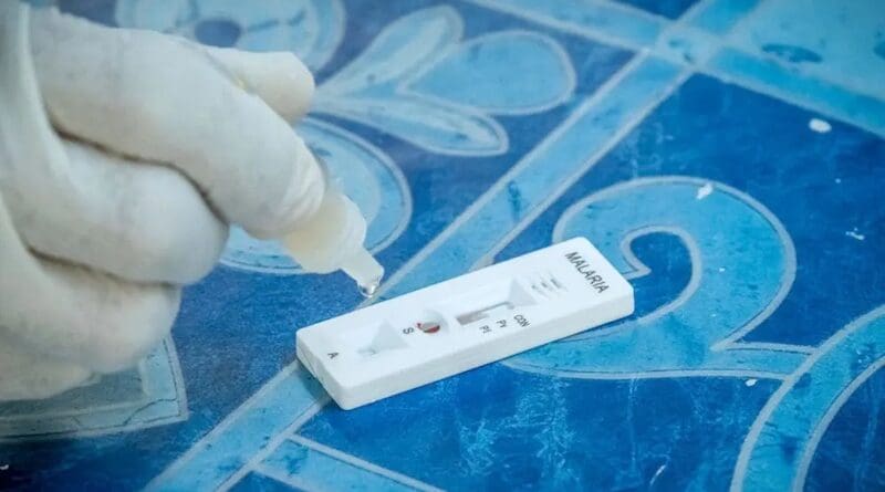 Testing for malaria at a private clinic in Dabein, Yangon, Myanmar. The disease affects around 4 million people a year in Southeast Asia, according to the World Health Organization (WHO). Copyright: Vlad Sokhin/WHO.