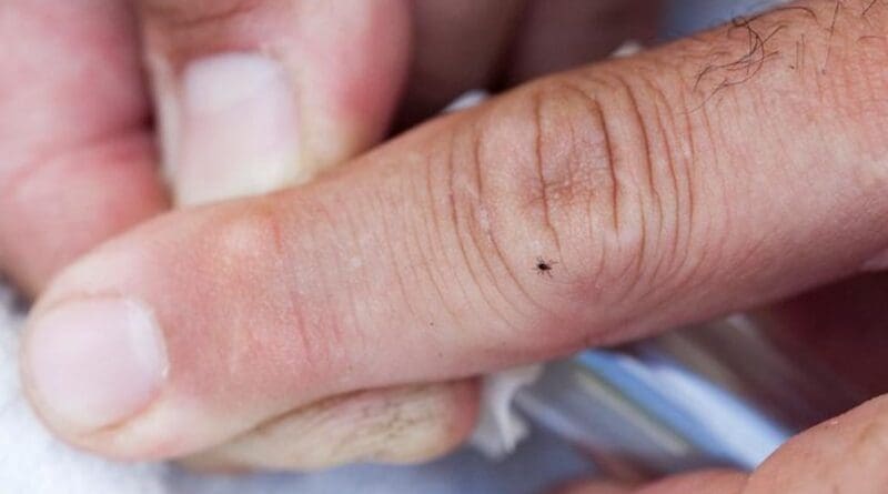 Current Lyme disease tests look for antibodies produced by the immune system in response to Borrelia burgdorferi bacteria. “The problem is that these antibodies don’t have the right characteristics to be clinically useful,” said Peter Gwynne, a research assistant professor at Tufts University School of Medicine. CREDIT Image: Kelvin Ma for Tufts University